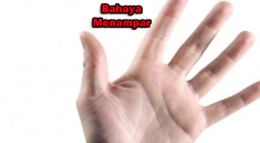 kes-cikgu-ibu-bapa-menampar-guru-bahaya-kecederaan-kepala